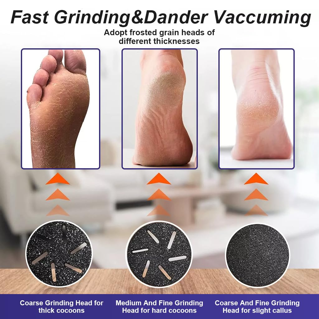 HANNEA Electric Callus Remover for Feet, with Set of 10 Pedicure Tools, Pedicure Electric Scrubber USB Rechargeable Heel Scrubber, Home Electric Callus Remover for Heels Gift for Father HANNEA Electric Callus Remover for Feet, with Set of 10 Pedicure Tools, Pedicure Electric Scrubber USB Rechargeable Heel Scrubber, Home Electric Callus Remover for Heels Gift for Father